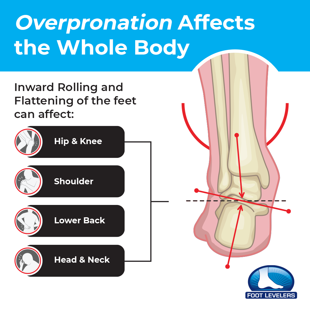 Foot Levelers Orthotics — R & R Family Chiropractic
